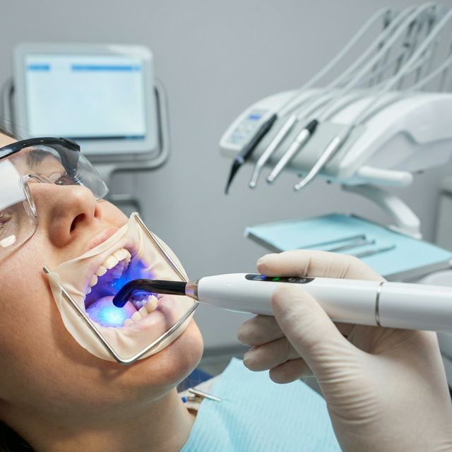 Basic Dental Fillings