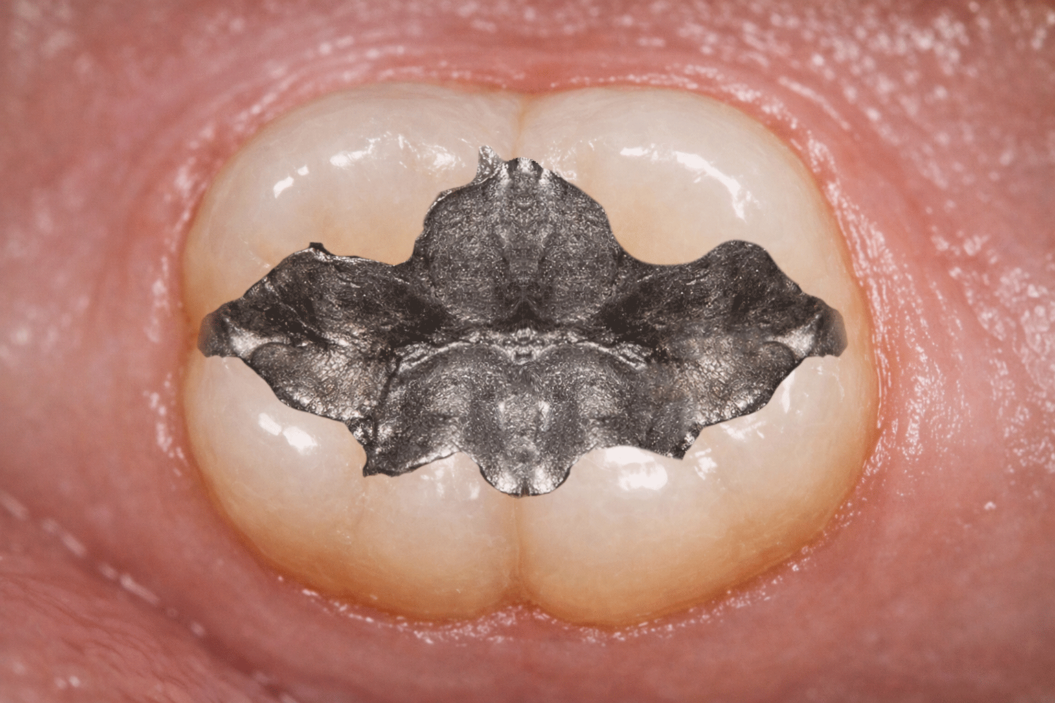 Before transformation