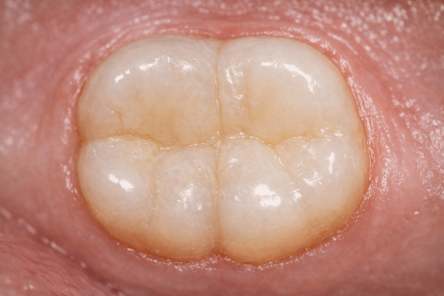 After transformation