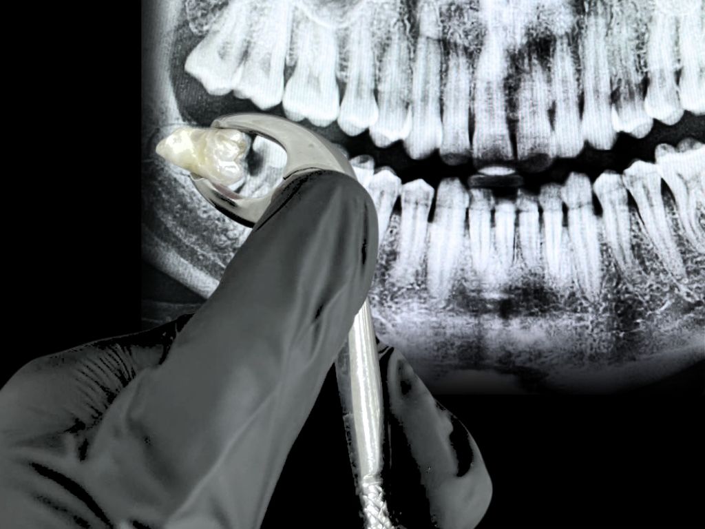 After transformation